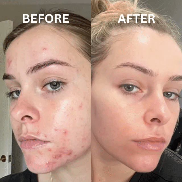 Korean Collagen Boosting Mask