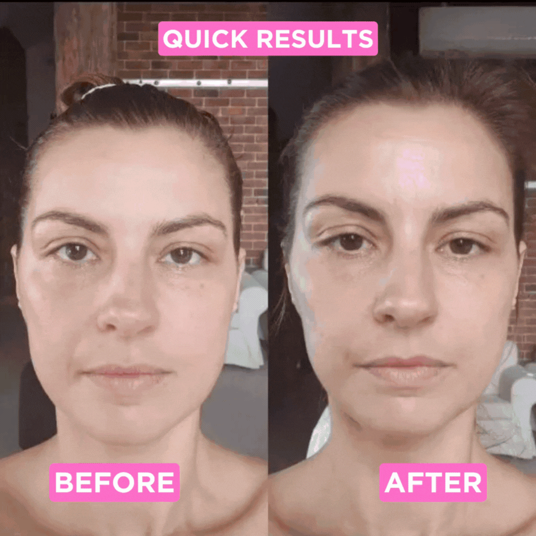 ATHERA 7-in-1 LED Facial Sculpter